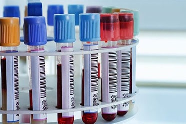 Business Interruption Loan Scheme